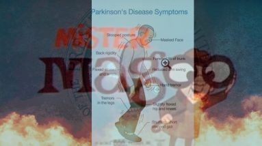 Dementia gate JoJo Magoo  will Fail Parkinson Test & MRI Scan and the Democratic Elite Know it